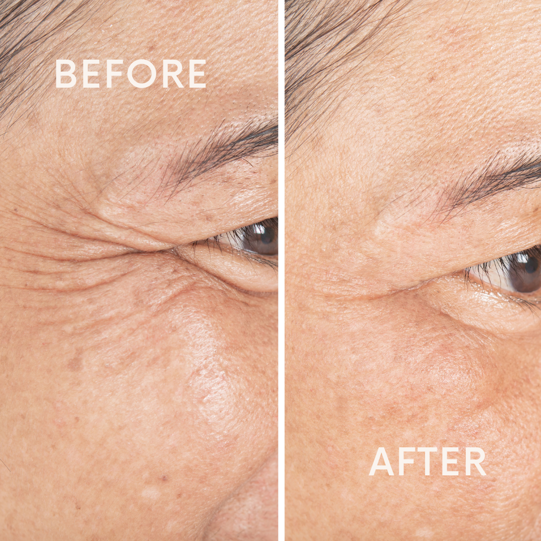 Protein Lift Serum