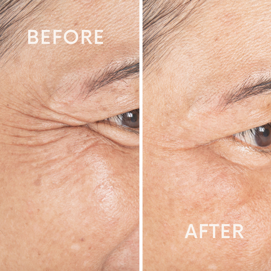 Protein Lift Serum